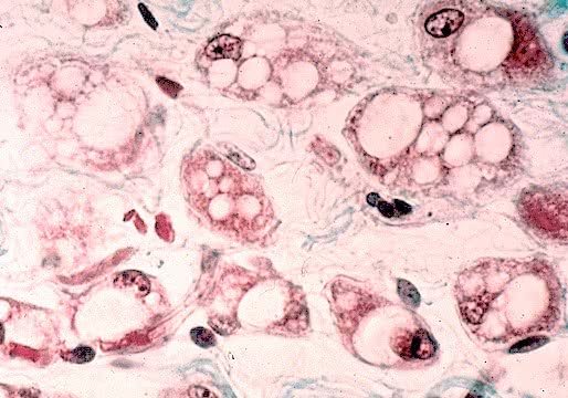 Biologia: Tecido adiposo – classificação, características e estrutura