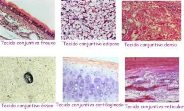 Biologia: Tecido Conjuntivo – O que é? Funções, Órgãos e Importância